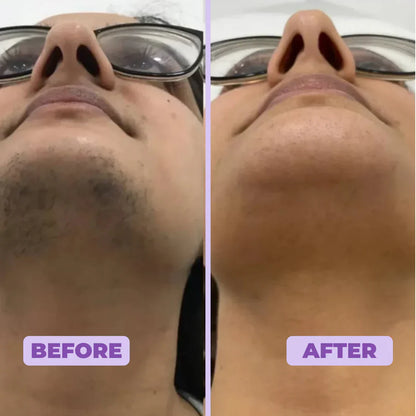 Facial Hair Removal Cream | 1+1 FREE