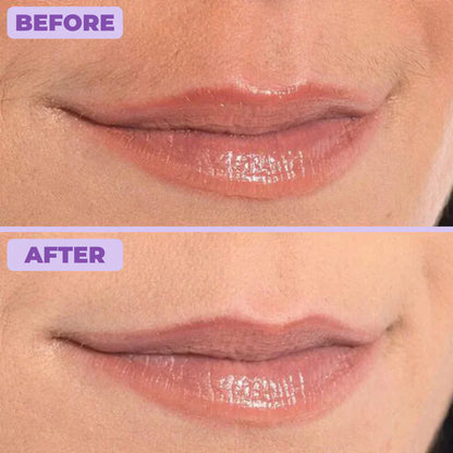 Facial Hair Removal Cream | 1+1 FREE